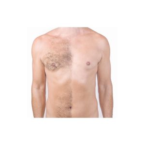 INTOME HAIR REMOVAL POWDER 70gr - ΣΚΟΝΗ ΑΠΟΤΡΙΧΩΣΗΣ 70gr - Image 6